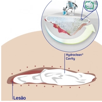 HIDROCLEAN CAVITY